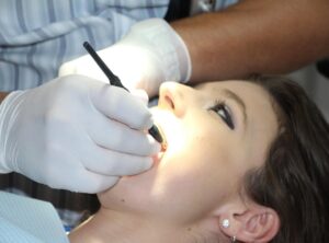Teeth Glarosoupa Cleaning Hack Hsfrespirate